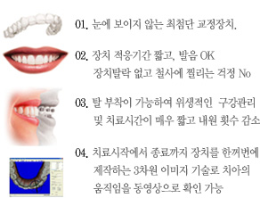 01. 눈에 보이지 않는 최첨단 교정장치.
02. 장치 적응기간 짧고, 발음 OK
장치탈락 없고 철사에 찔리는 걱정 No
03. 탈 부착이 가능하여 위생적인  구강관리 
및 치료시간이 매우 짧고 내원 횟수 감소 
04. 치료시작에서 종료까지 장치를 한꺼번에 
제작하는 3차원 이미지 기술로 치아의 
움직임을 동영상으로 확인 가능