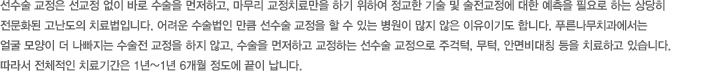 선수술 교정은 선교정 없이 바로 수술을 먼저하고, 마무리 교정치료만을 하기 위하여 정교한 기술 및 술전교정에 대한 예측을 필요로 하는 상당히 
전문화된 고난도의 치료법입니다. 어려운 수술법인 만큼 선수술 교정을 할 수 있는 병원이 많지 않은 이유이기도 합니다. 푸른나무치과에서는 
얼굴 모양이 더 나빠지는 수술전 교정을 하지 않고, 수술을 먼저하고 교정하는 선수술 교정으로 주걱턱, 무턱, 안면비대칭 등을 치료하고 있습니다. 
따라서 전체적인 치료기간은 1년~1년 6개월 정도에 끝이 납니다.